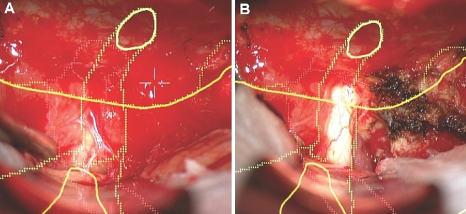 FIGURE 11.