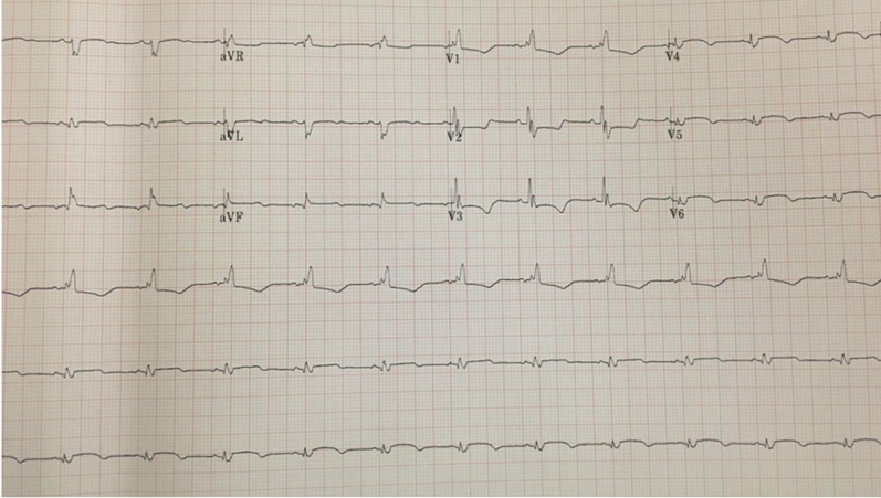 Figure 1