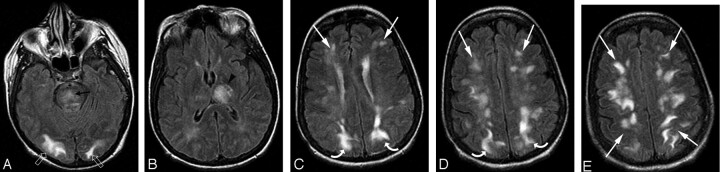 Fig 2.