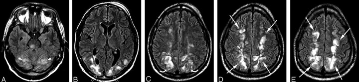 Fig 3.