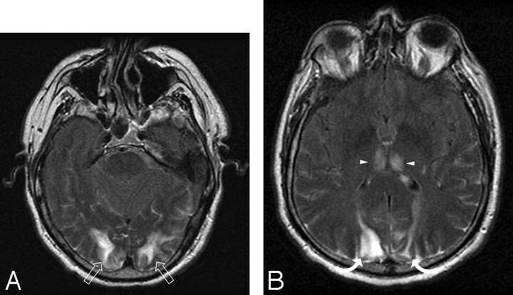 Fig 5.