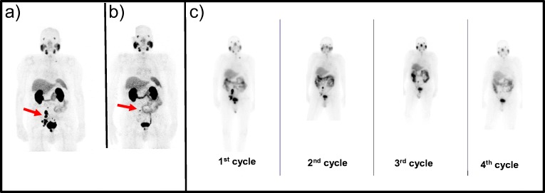 Fig. 1