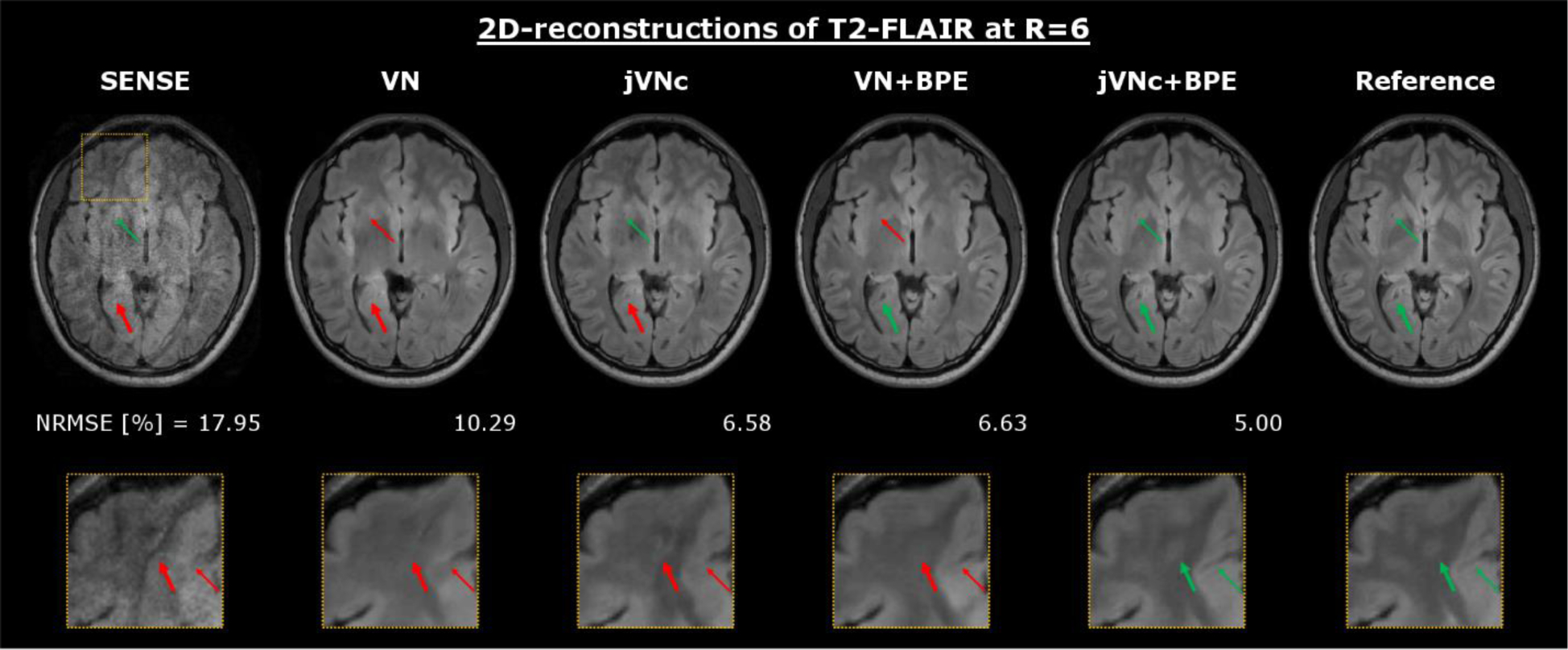 Figure 3: