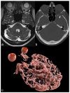 Figure 14