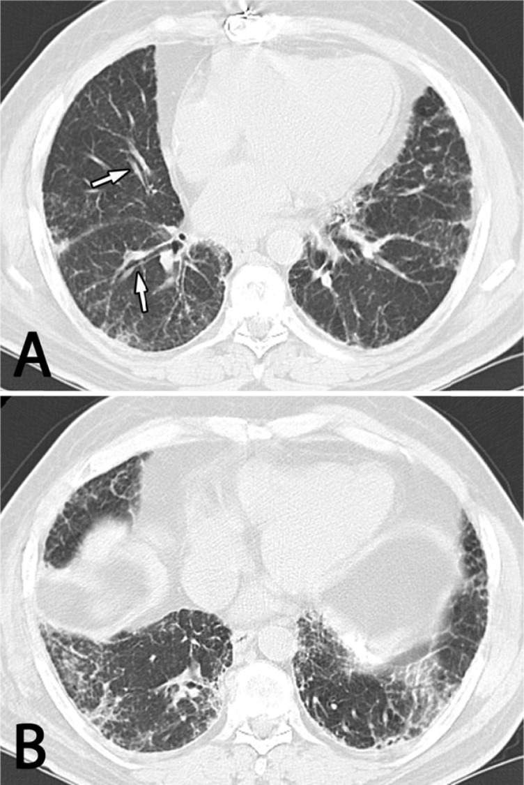 Fig. (1)