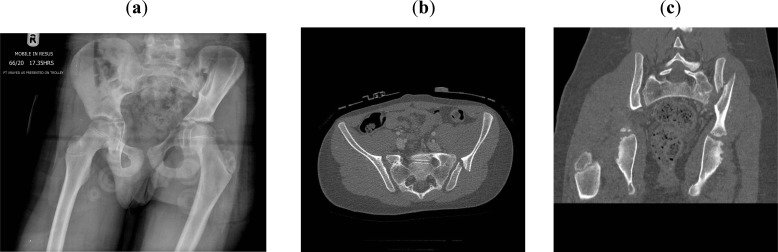 Fig. (1)