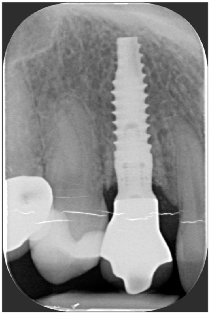 Figure 16