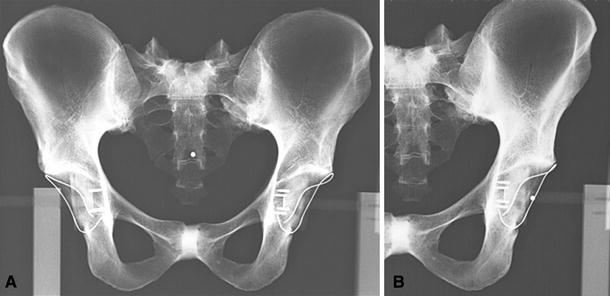 Fig. 5