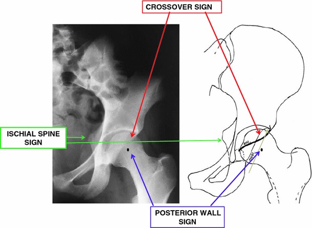Fig. 3