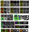 Fig. 6. Basolateral and rhabdomere transport is inhibited in Sec71E677K-expressing photoreceptors. (A–G) Immunostaining of retinas from Rh1-Gal4/+ (upper panels) and Rh1-Gal4/UAS- Sec71E677K (lower panels) late-pupal flies. Sec71E677K is expressed in the R1–6 peripheral photoreceptors (A–C,E–G). Immunostaining of retinas from Rh1-Gal4/UAS-Syx5::myc (upper panels) and Rh1-Gal4/UAS-Syx5::myc, UAS- Sec71E677K (lower panels) late-pupal flies. Sec71E677K is expressed in the R1–6 peripheral photoreceptors (D). Anti-Rab6 (green) and anti-MPPE (red) antibodies (A). Anti-Rab11 (green) and anti-Rab6 (red) antibodies (B). Anti-GM130 (green) and anti-Rab6 (red) antibodies (C). Anti-myc (green) and anti-MPPE (red) antibodies (D). Anti-αCOPI (green) and anti-MPPE (red) antibodies (E). Anti-AP1γ (green) and anti-Rab6 (red) antibodies (F). Anti-Na+K+-ATPase-α (green), anti-Rab6 (red), and anti-Rh1 (blue) antibodies (G). Arrows indicate Golgi stacks in the wild-type cells, and arrowheads indicate the foci of cis-Golgi makers surrounding the medial and late Golgi aggregates. Cytoplasmic accumulation of Rh1 is indicated by asterisks. (H) Immunostaining of retinas from Rh1-Gal4/UAS-Sec71E677K late-pupal flies using anti-Na+K+-ATPase-α (green), anti-Rab6 (red), and anti-Rh1 (blue) antibodies. (I–L) Immunostaining of retinas dissected from Sec71-RNAiGLC01657 (I,J,L, left) or Sec71RNAiHMS00357 (K,L, right) mosaic retinas. GFP marks Sec71-RNAi-expressing cells. Anti-GM130 (red) and anti-Rab6 (blue) antibodies (I). Anti-Na+K+-ATPase-α (red) and anti-Rh1 (blue) antibodies (J,K). Anti-Eys antibody (red) (L), Arrows indicate Golgi stacks in the wild-type cells, and arrowheads indicate the foci of cis-Golgi makers surrounding Golgi aggregates. (M) Immunostaining of retinas from Rh1-Gal4/+ (left) and Rh1-Gal4/UAS- Sec71E677K (right) late-pupal flies. Sec71E677K is expressed in the R1–6 peripheral photoreceptors. Anti-Rh1 (green) and anti-Eys (red) antibodies. Cytoplasmic accumulation of Rh1 and Eys is indicated by asterisks. Scale bars: 5 μm (A–G), 2 μm (H), 50 μm (I, upper), 5 μm (I, lower, J–M).