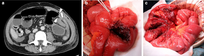 Fig. 4