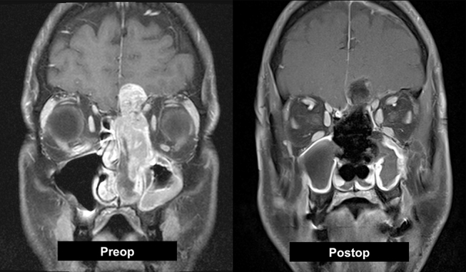 Fig. 3