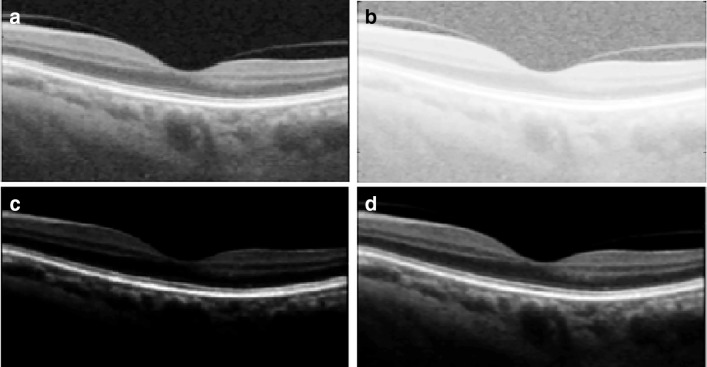 Fig. 2