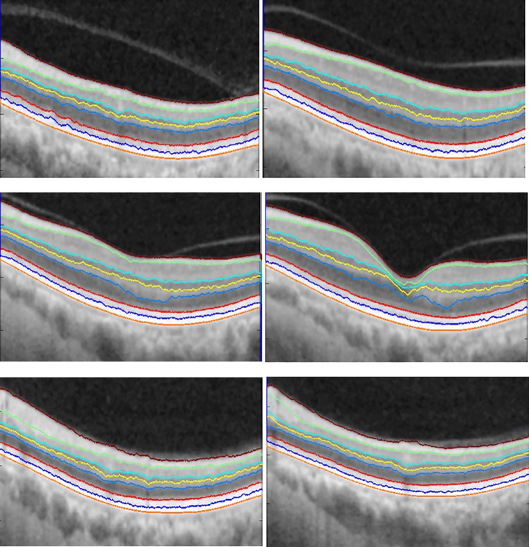 Fig. 4