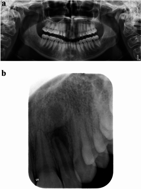 Fig. 4