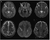 Fig. 10