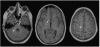 Fig. 14