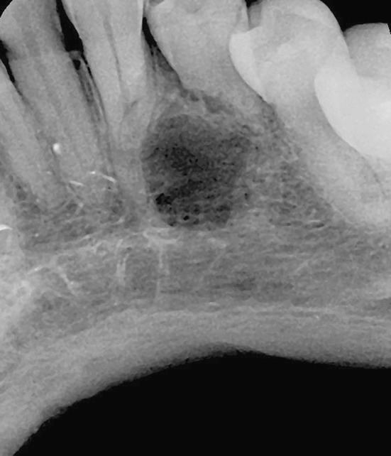 Fig. 4