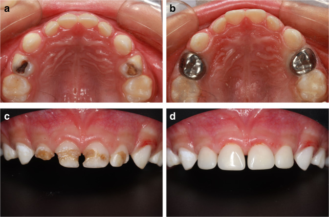 Fig. 2