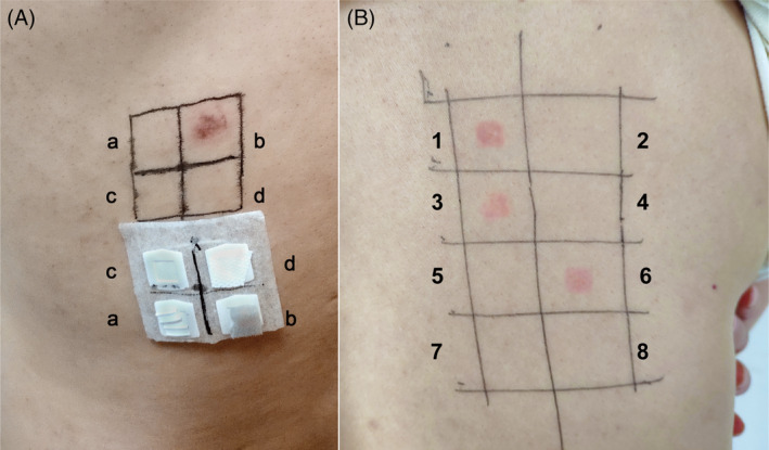 FIGURE 2