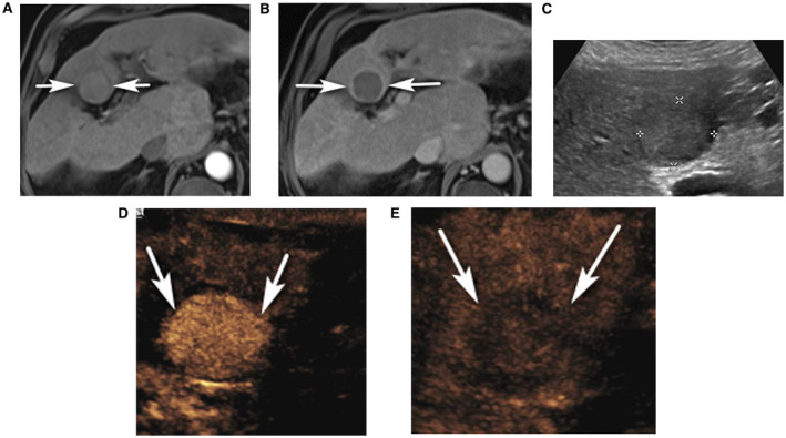 FIG 5