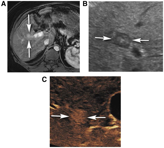 FIG 2