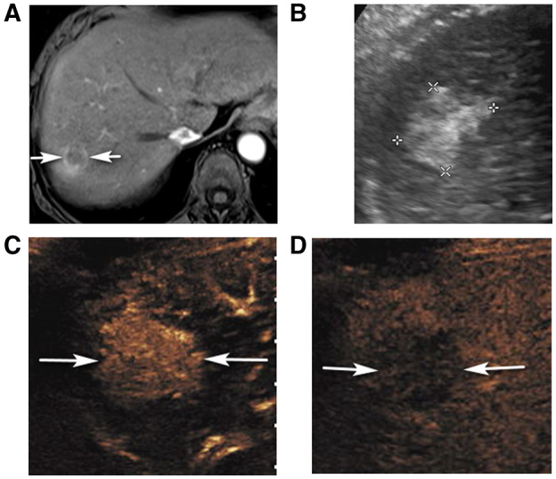 FIG 3