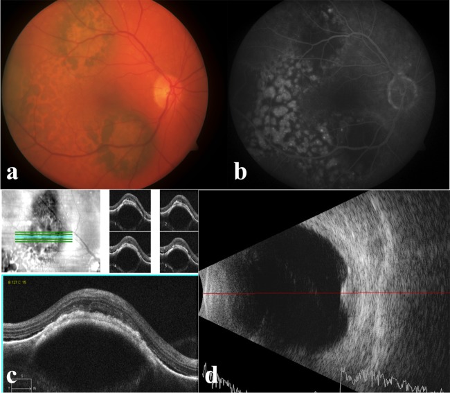 Figure 1