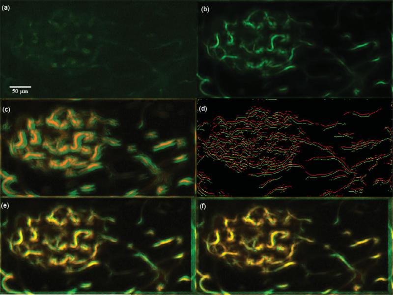 Figure 18