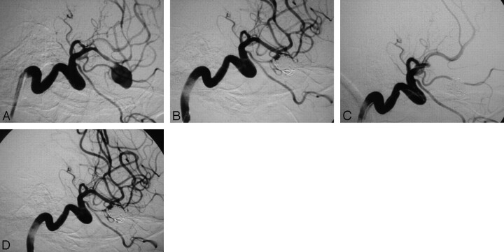 Fig 2.