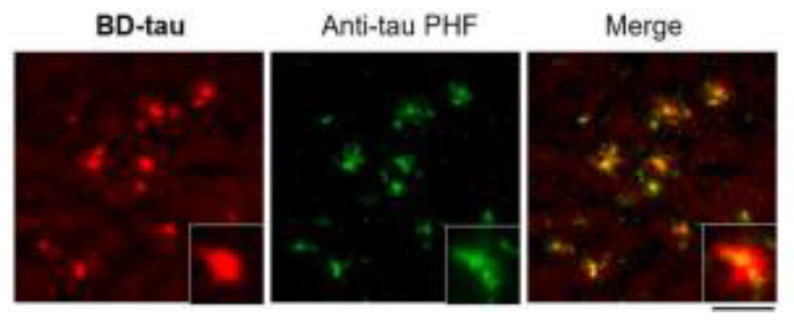 Figure 11