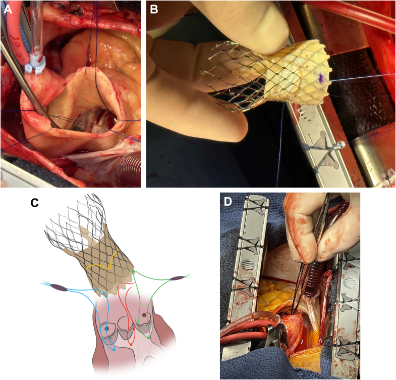 Figure 2