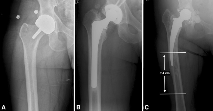 Fig. 1A–C