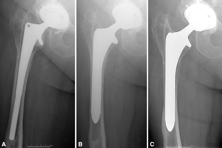 Fig. 2A–C