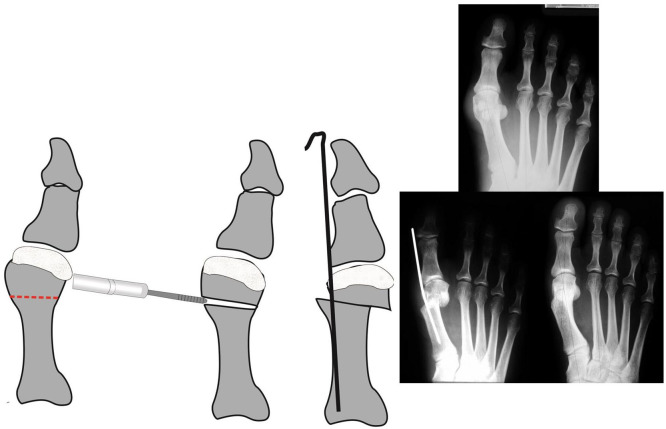 Fig. 2