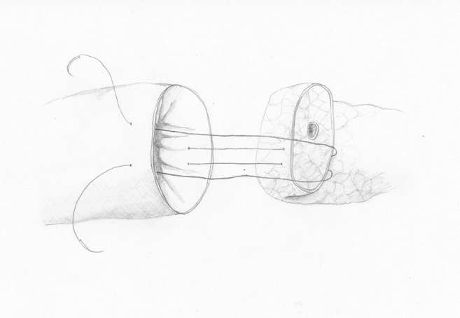 Fig. 2