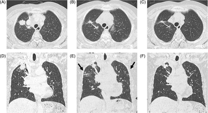 FIGURE 2