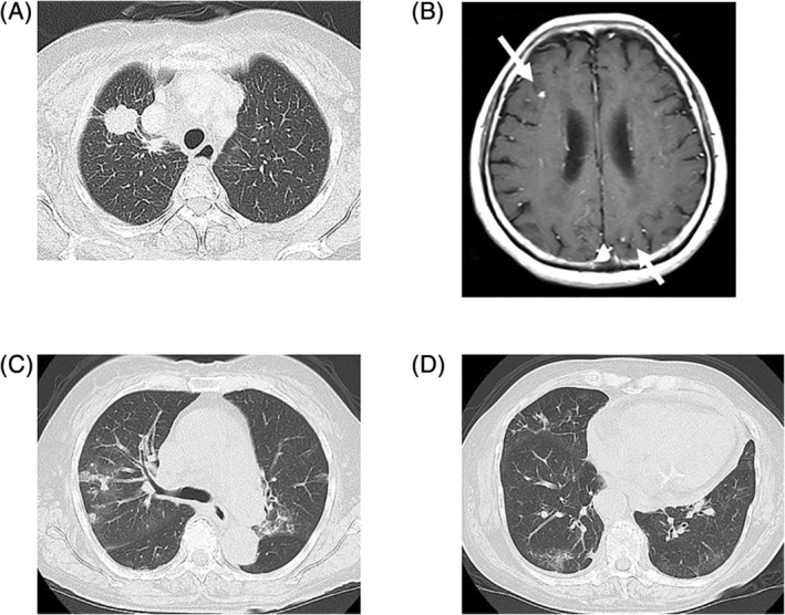 FIGURE 1