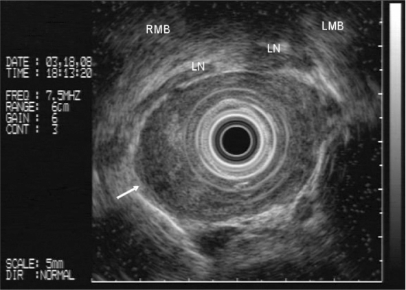 Figure 1 -