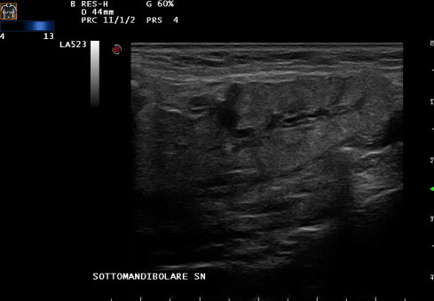 Fig. 2