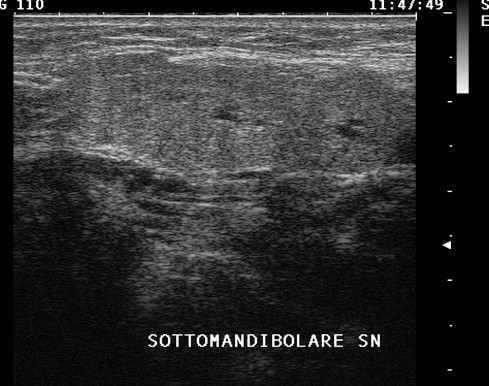 Fig. 4