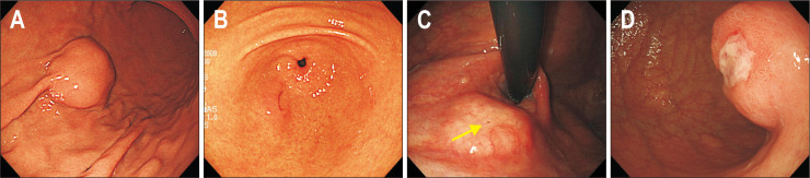 Fig. 4