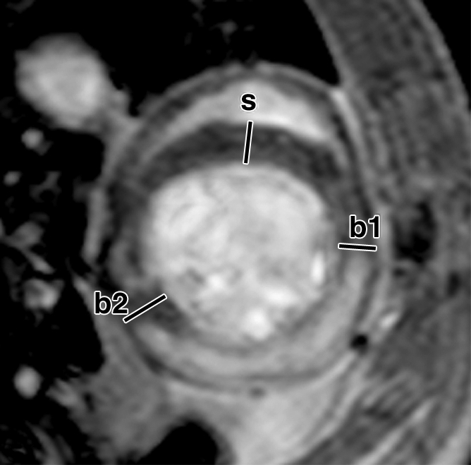 Figure 6c: