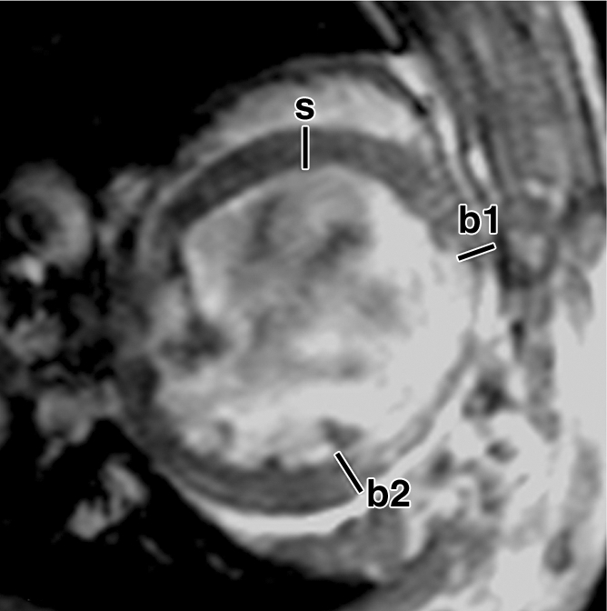 Figure 6b: