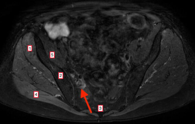 FIG. 1.