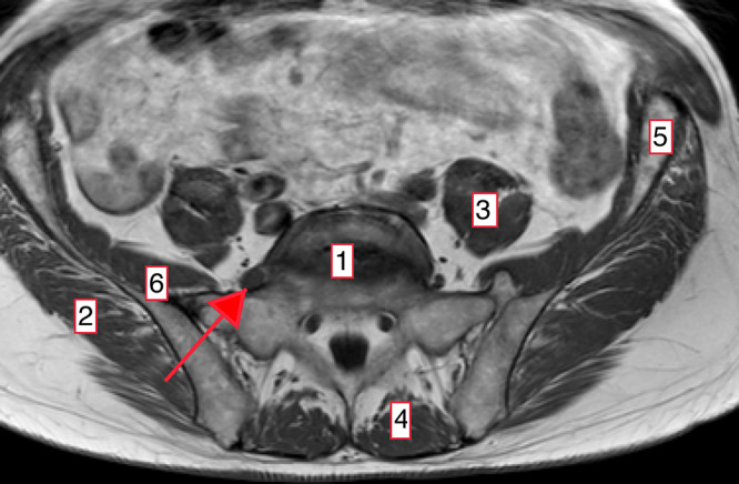 FIG. 4.