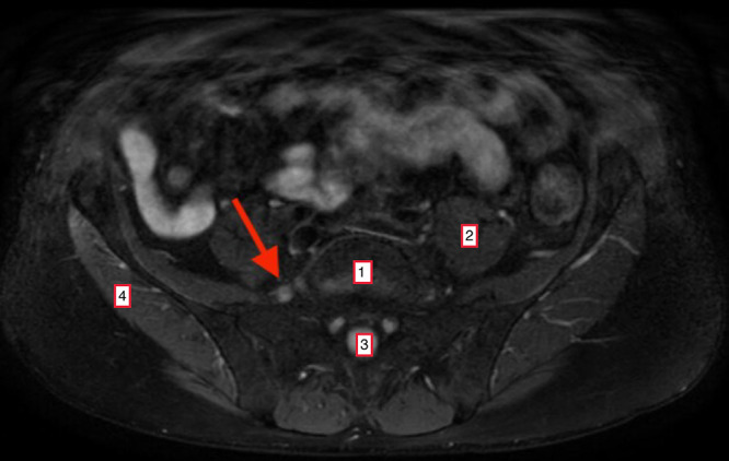 FIG. 2.