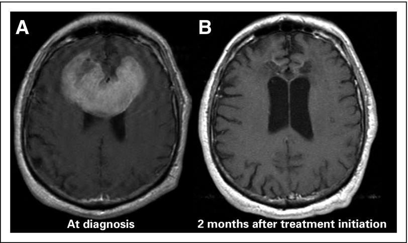 Fig 3.