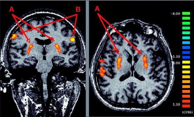 Fig 1.