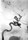 Fig 4.